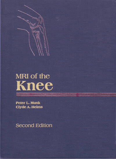 MRI of the Knee - Second Edition